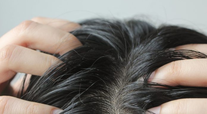 Swędzenie i łupież zniknęły po pierwszym użyciu! Ten szampon to ratunek dla wrażliwego skalpu