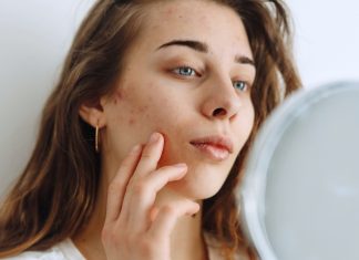 Masz cerę trądzikową i tłustą? Odbuduj barierę hydrolipidową i wycisz stany zapalne