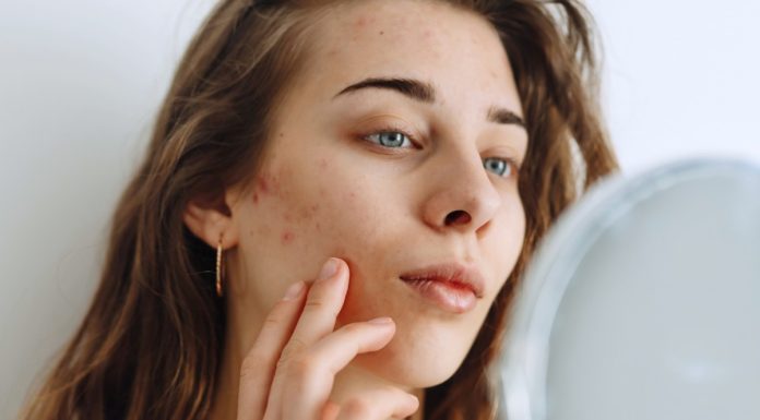 Masz cerę trądzikową i tłustą? Odbuduj barierę hydrolipidową i wycisz stany zapalne