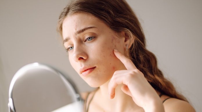 Produkty, które mogą wywoływać wypryski nawet u dorosłych. Na liście dermatologów są suplementy