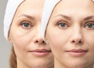 Ciągle jesteś opuchnięta? Ten balsam z elektrolitami robi różnicę już po pierwszym użyciu