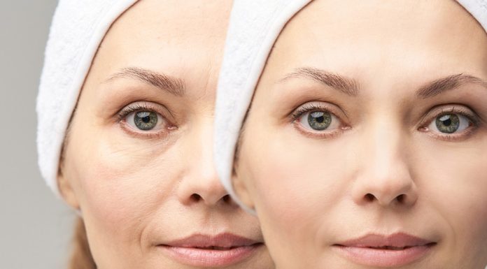 Ciągle jesteś opuchnięta? Ten balsam z elektrolitami robi różnicę już po pierwszym użyciu