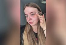 Kupiła opakowanie za 22 zł. Przetestowała płatki pod oczy z Biedronki